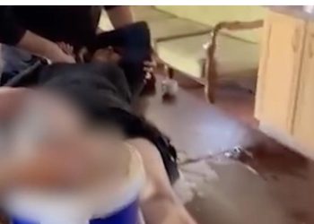 Dokter Gaza amputasi kaki keponakannya di meja dapur tanpa anestesi